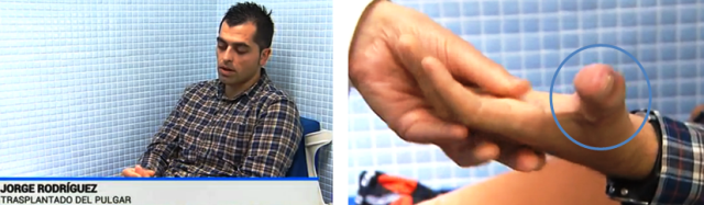 caso1_TVE_20150210_2