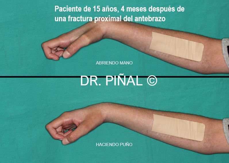 Limitaciones funcionales de la paciente