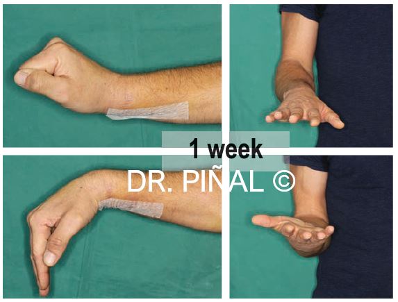 Pronation and supination
