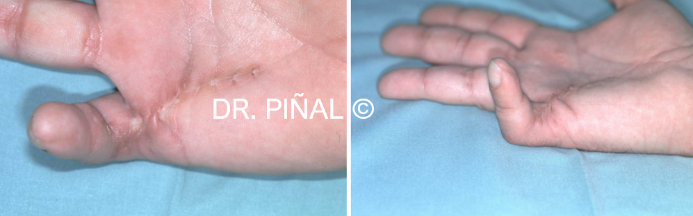 Preoperative status of the patient 